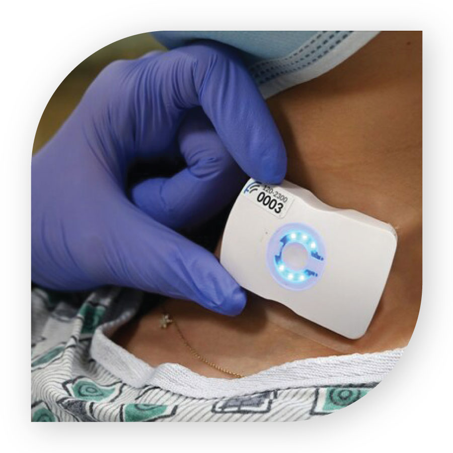 FloPatch for fluid management, made by Flosonics